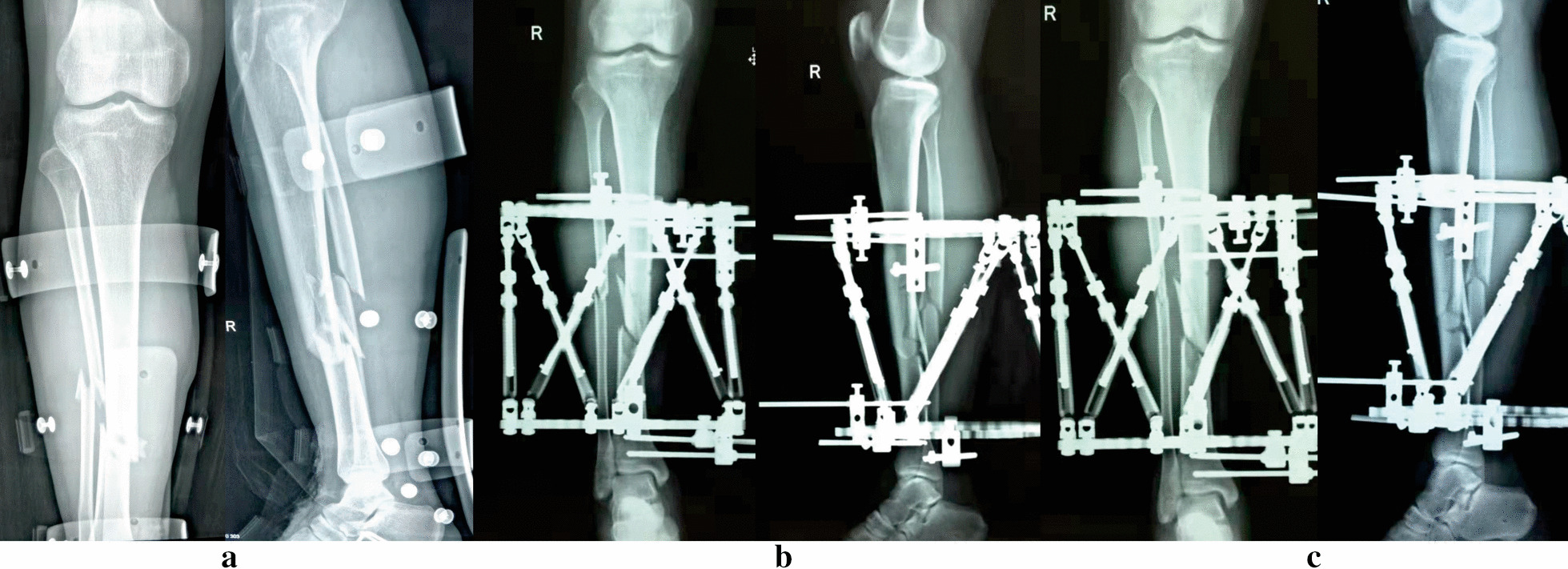 Fig. 3