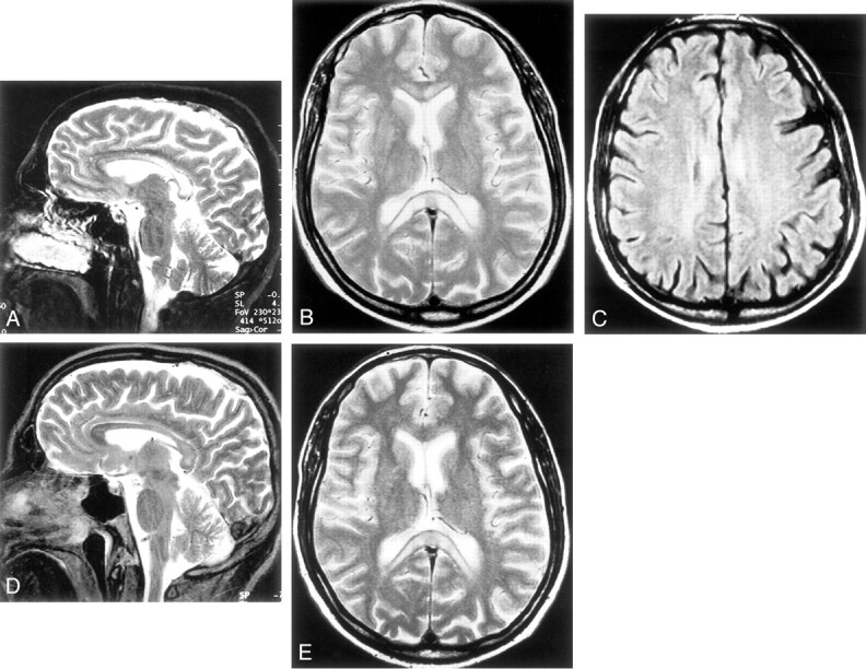 Fig 2.