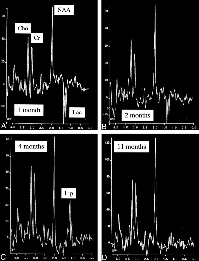 Fig 3.