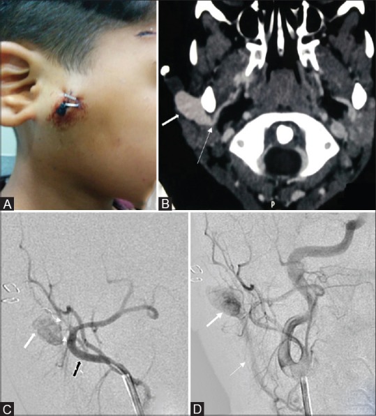 Figure 1 (A-D)