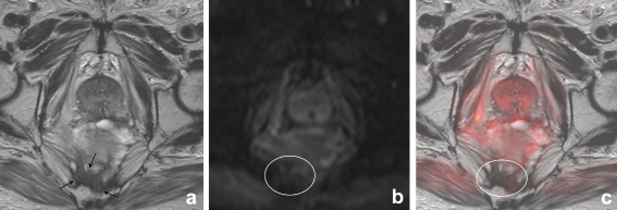 Fig. 3