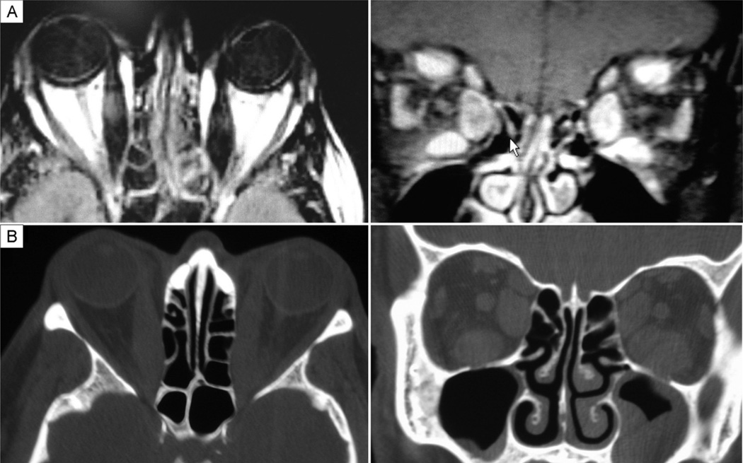 FIG 3