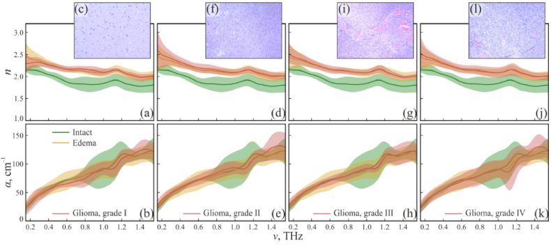 Fig. 12.