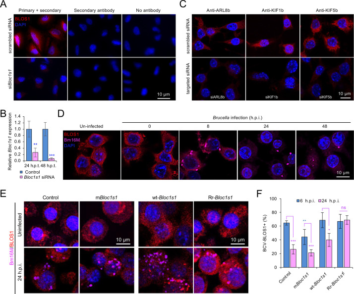 Figure 4—figure supplement 3.