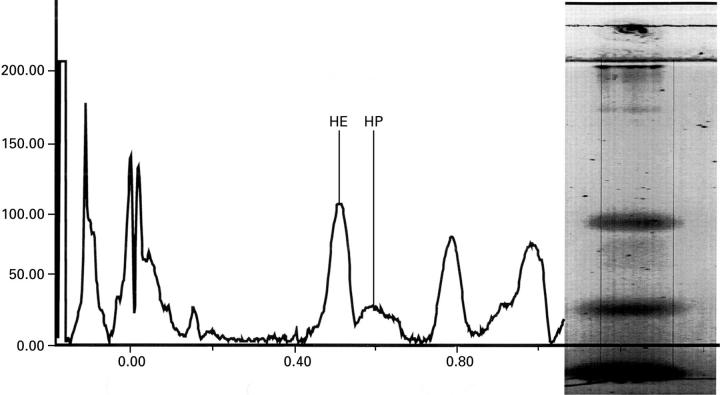 Figure 1  