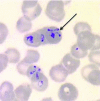 Fig 2.