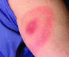 Fig 1.