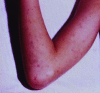 Fig 4.