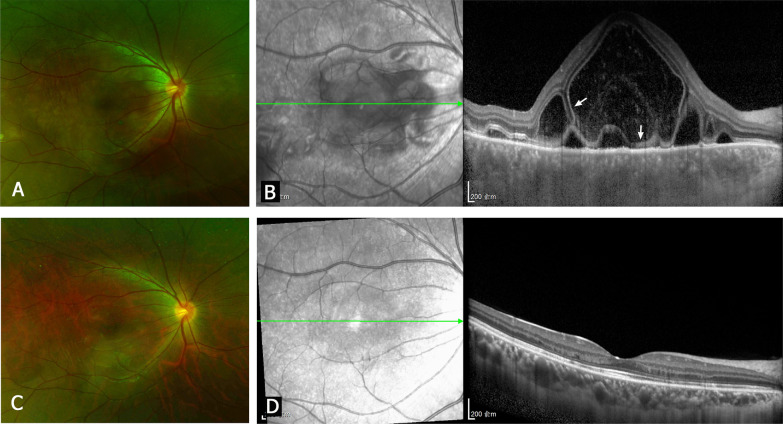 Fig. 1
