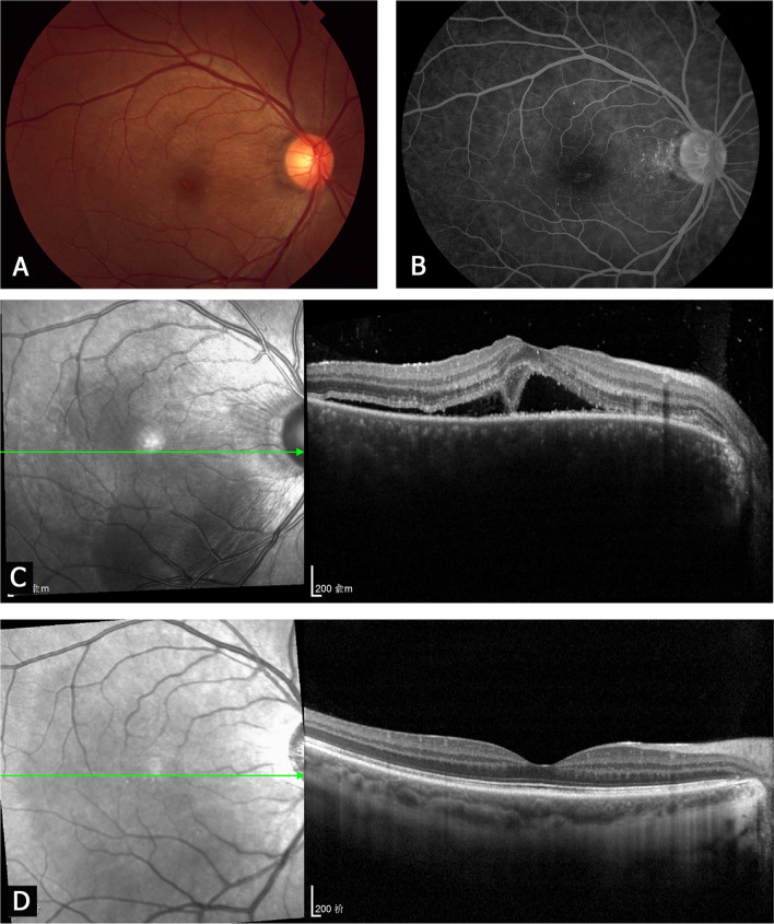 Fig. 2