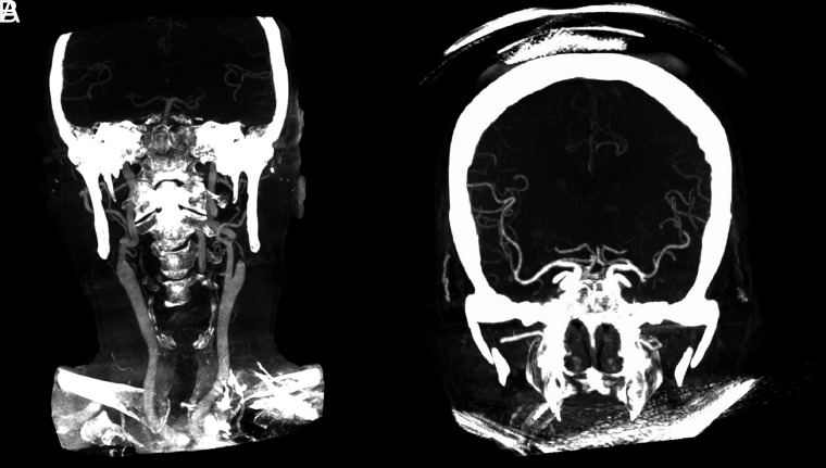 FIG 4.