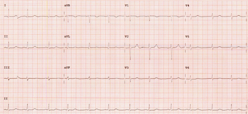 Figure 2