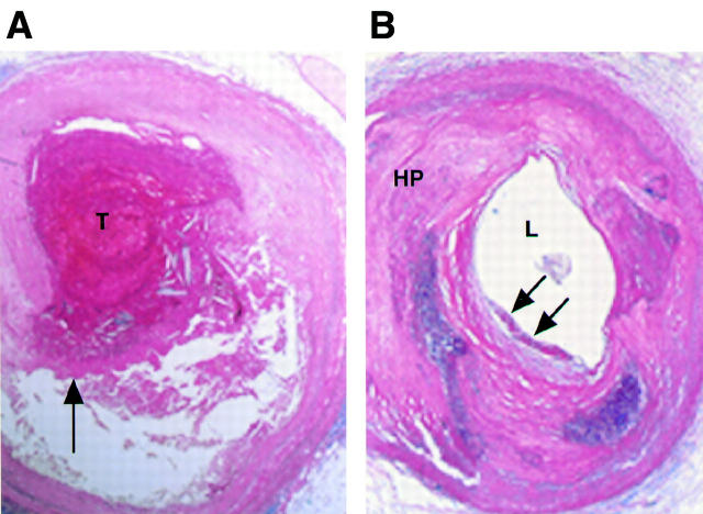 Figure 1  