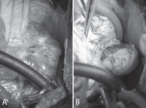 Figure 3)