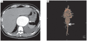 Fig.1