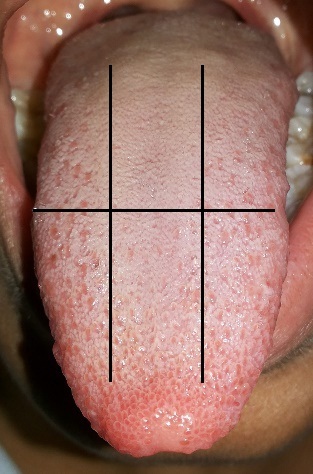 [Table/Fig-4]: