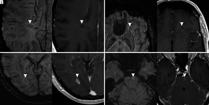 FIG 2.