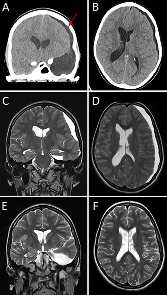 FIG. 2.
