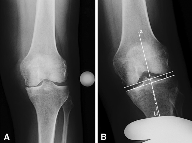 Fig. 1A–B