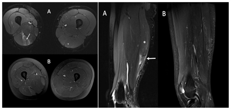 Figure 3 A, B