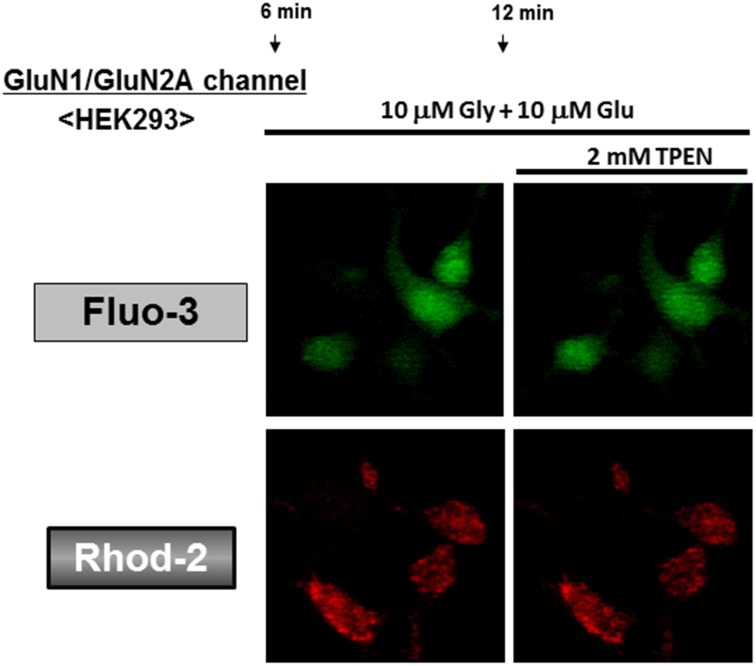 Fig 11