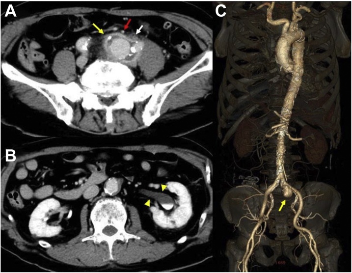 Fig. 1