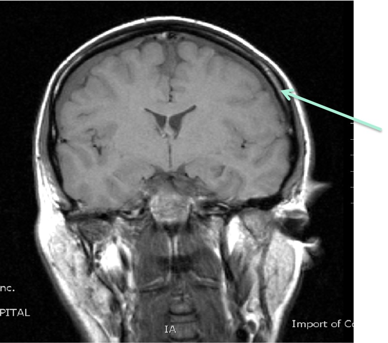 Fig. 3