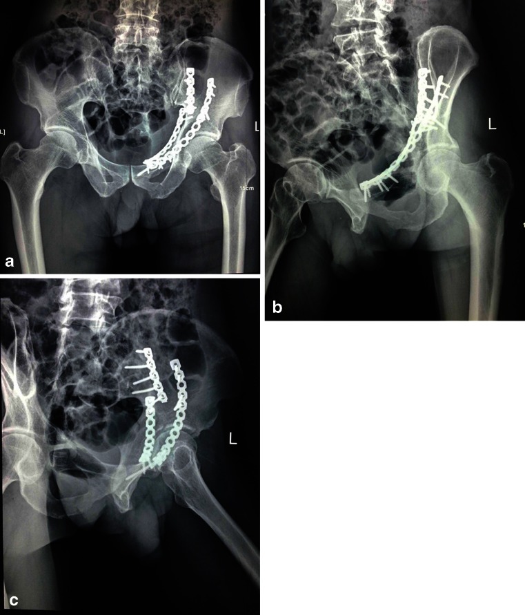 Fig. 4