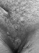 graphic file with name JIA2-25-e26009-g041.jpg