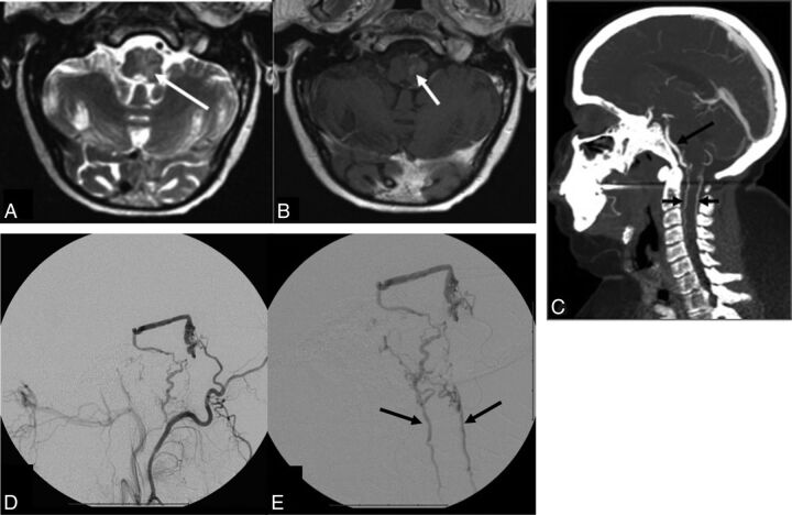 Fig 3.