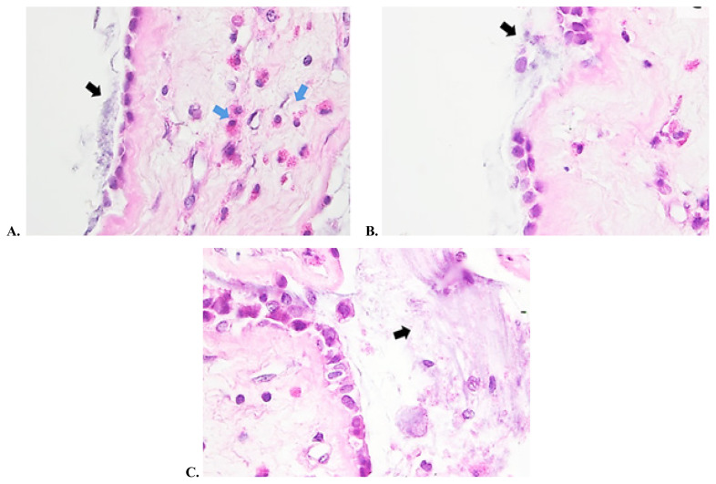 Figure 9 (A, B, C)