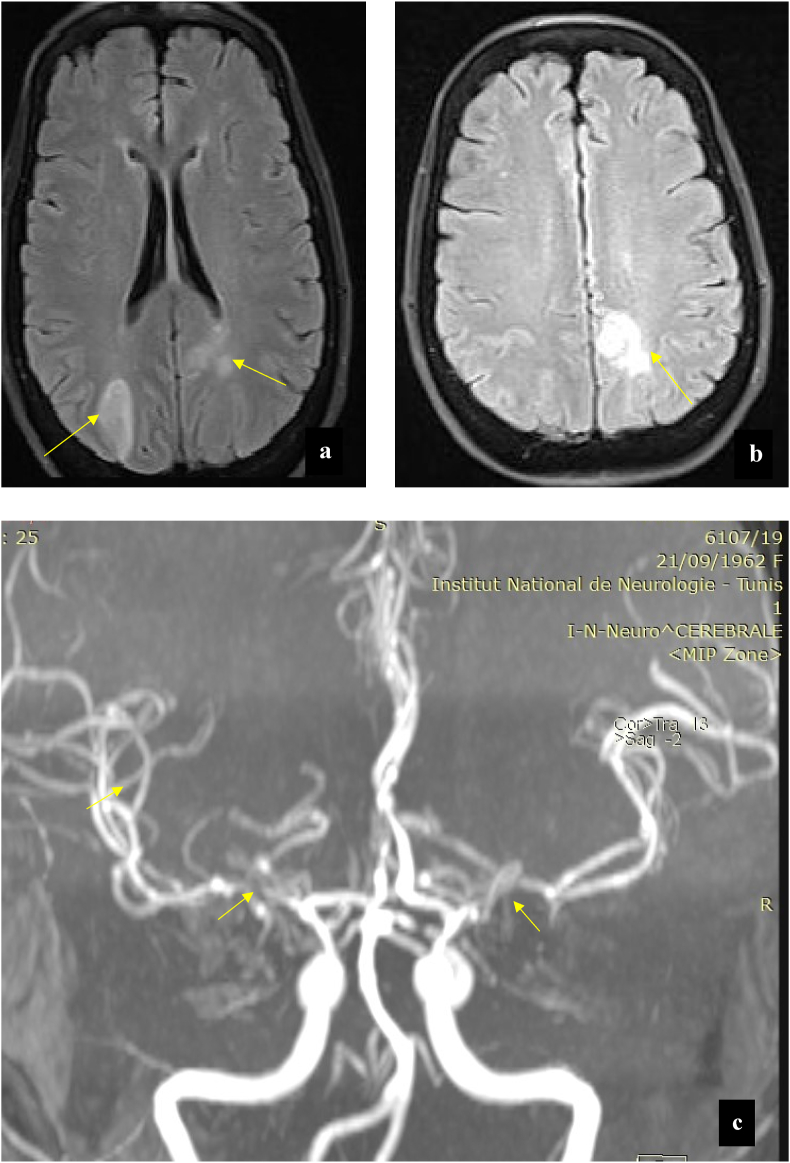 Fig. 1