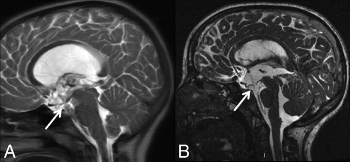 Fig 3.