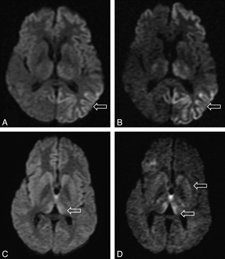 Fig 2.