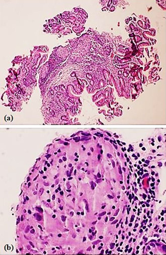 Figure 2