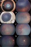 Fig. 3
