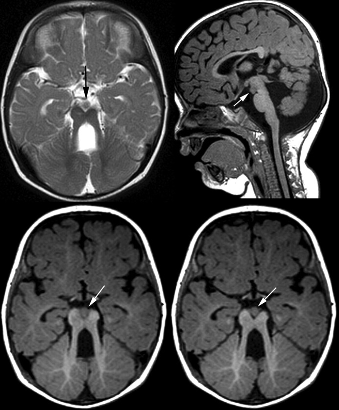 Fig 1.