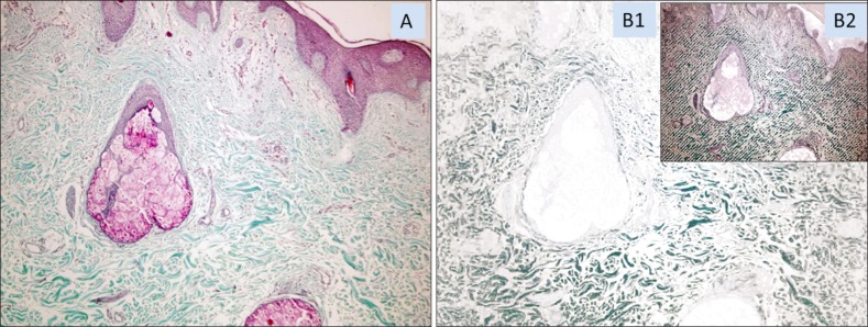 Fig. 2