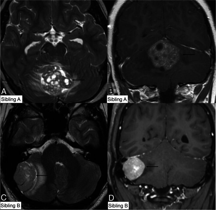 FIG 2.