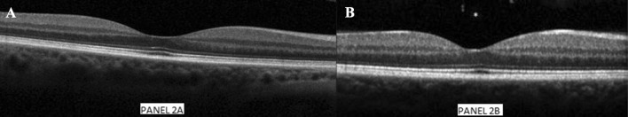 Fig. 2