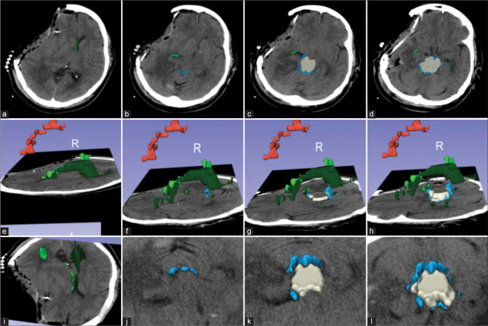 Figure 2: