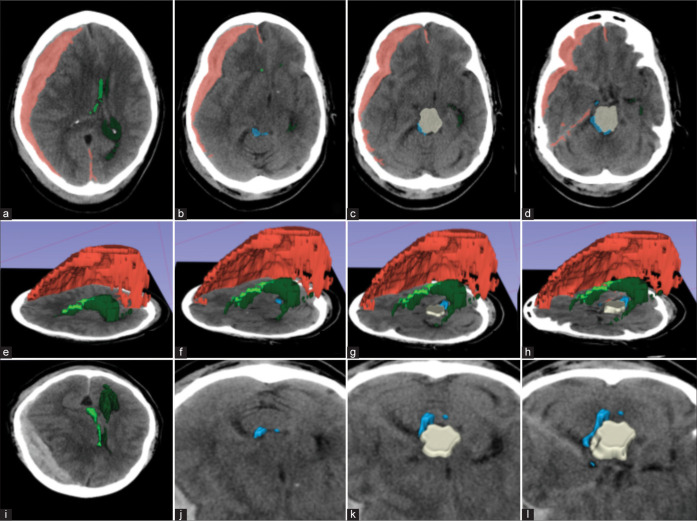 Figure 1: