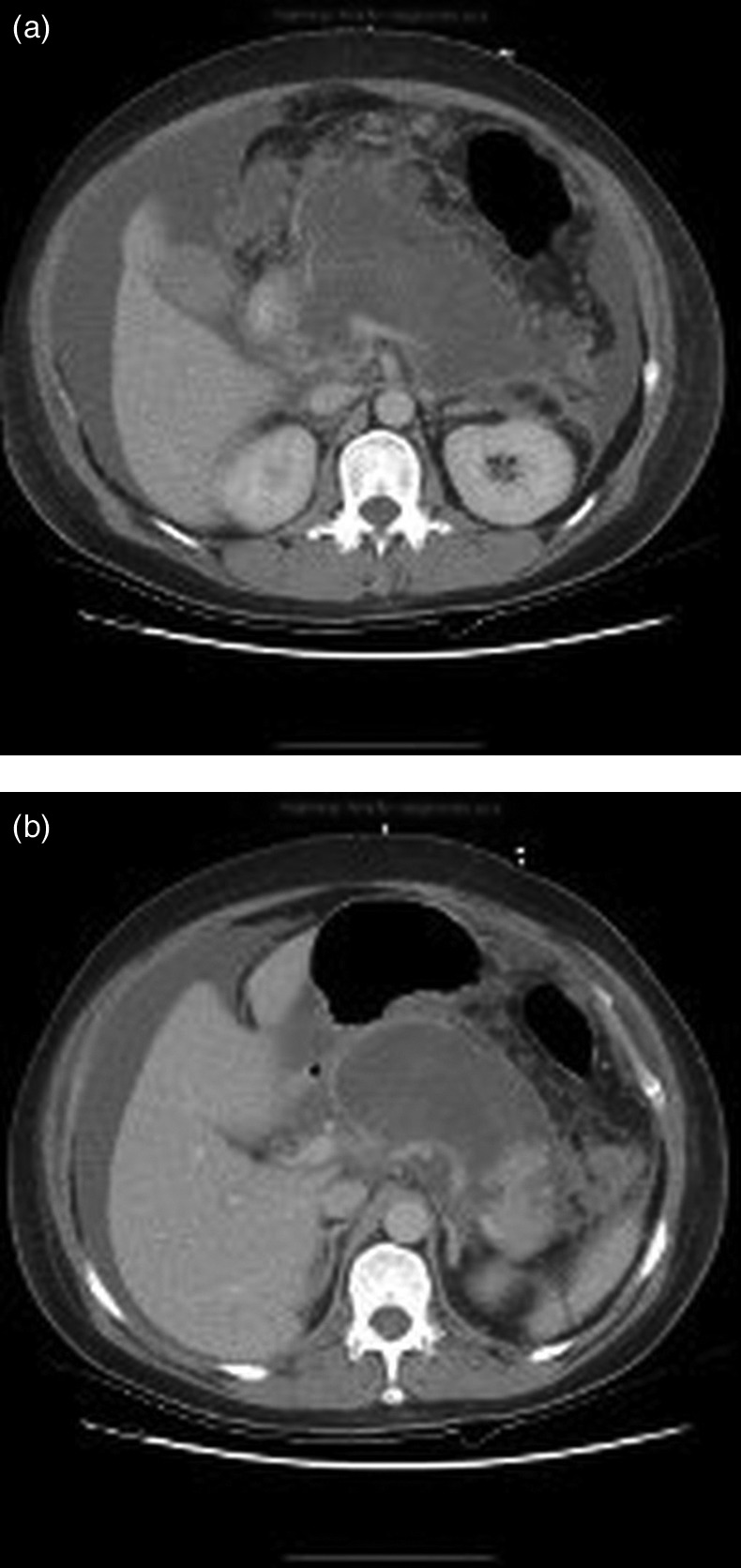 Figure 2