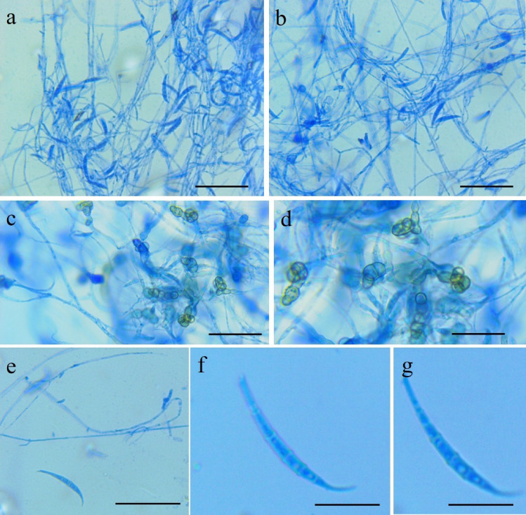 Fig. 94