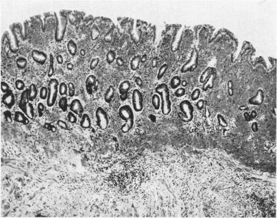 Fig. 1c.