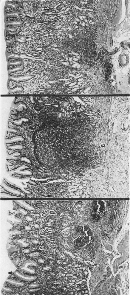 Fig. 5a., Fig. 5b., Fig. 5c.