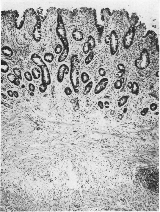 Fig. 1b.