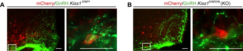 Figure 2—figure supplement 1.