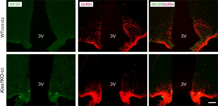 Figure 3—figure supplement 2.