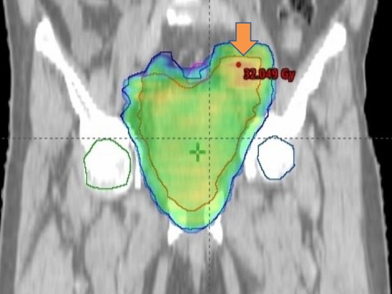 Figure 9